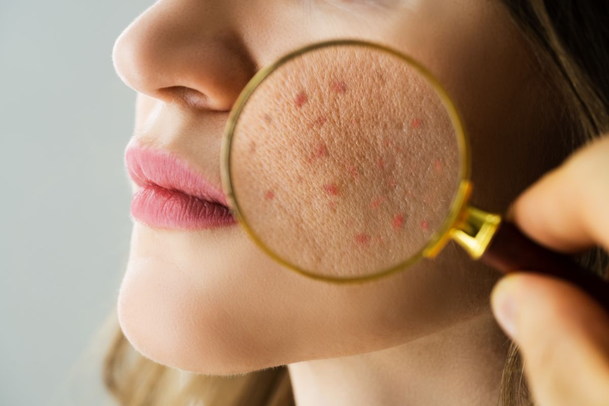 Remboursement dermatologue mutuelle